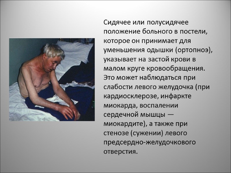 Сидячее или полусидячее положение больного в постели, которое он принимает для уменьшения одышки (ортопноэ),